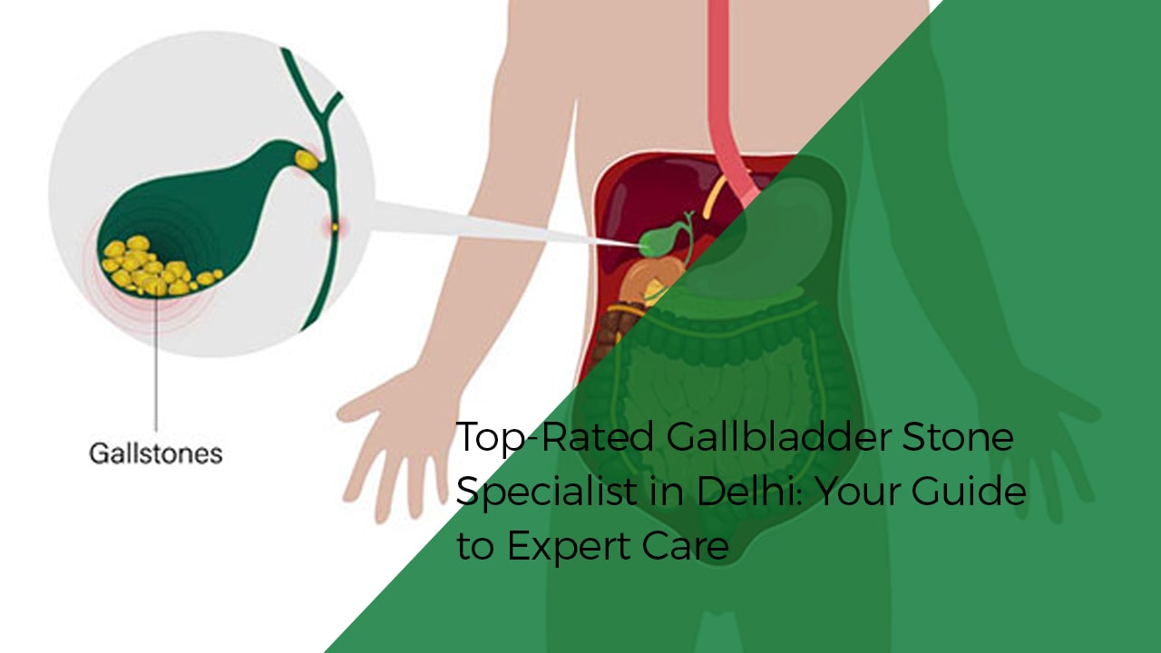 Top-Rated Gallbladder Stone Specialist in Delhi: Your Guide to Expert Care