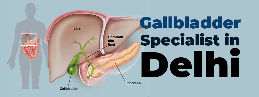 Expert Gallbladder Specialist in Delhi: Who to Trust with Your Health