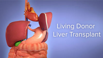 Medical Animation: Living Donor Liver Transplant