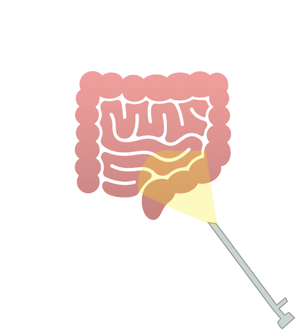 Minimally Invasive Liver Surgery